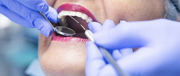 Professional Emergency Dental Service in IA